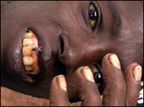 Một phụ nữ Ấn Độ nhiễm HIV