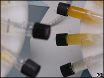 Samples from sports men and women to test for illegal substances