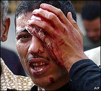 Homem ferido nas eleições do Egito