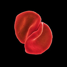 Review of Scratch My Back