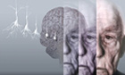 computer illustration of the brain of an elderly man with alzheimer's.