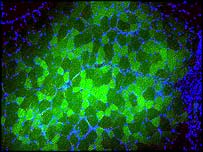 Záběr z ultrazvuku