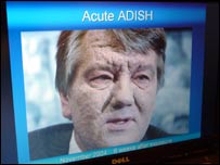 Фото 1: Віктор Ющенко після отруєння