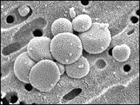 nanobacteriile: forme vii?