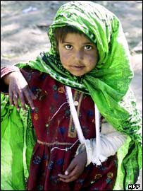 دختر پاکستانی در زلزله مجروح شده است