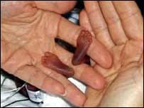 Médico segura os pés de Amillia Taylor