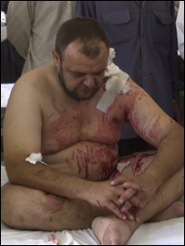 Iraquiano ferido após bombardeios americanos em Falluja