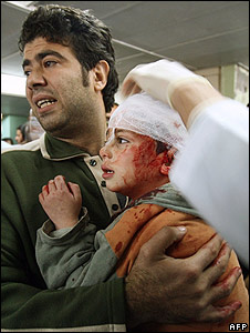 Garoto ferido em hospital na Cidade de Gaza