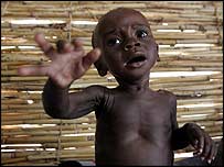 Criança vítima da fome no Níger