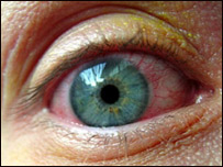 د سترګو پردې