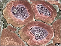 Mielina no sistema nervoso