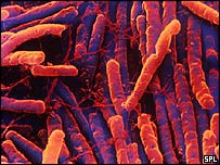 A bactéria Clostridium difficile Foto: Science Photo Library