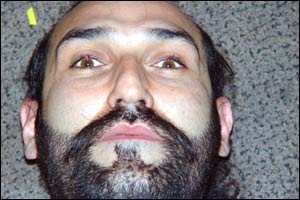 نه ... آسپرين بود