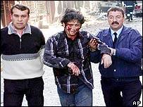 ترکی میں بم حملوں کے زخمی