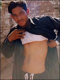 बँधुआ मज़दूर