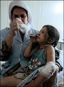 Một nữ y tá bế em bé bị thương