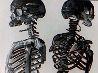 Duo skeletons