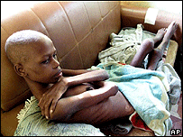 ایڈز کے مریض