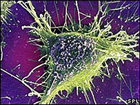 Célula da Alzheimer