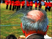 बाल गिरने के कई कारण हो सकते हैं