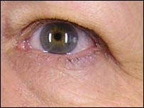 Voluntária depois do tratamento