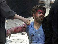 Ferido em atentado no Iraque