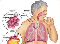 سينه او بغل