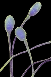 显微镜下的精子