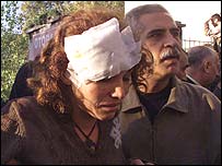 हमले में घायल एक महिला