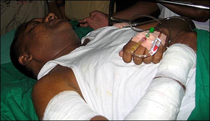 Journalist Mawalage in the hospital (photo Elmo Fernando)