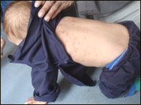 ګرګ ( سکبيس )