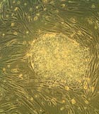 A colony of stem cells viewed under a microscope