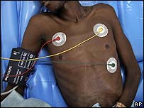 Portador do vírus da Aids em hospital na África