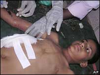 پسری که در اثر يکی از اين انفجارها مجروح شده است