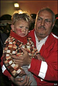 घायल फ़लस्तीनी बच्चा