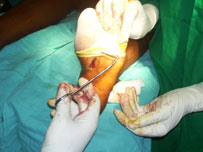 The surgery at the hospital (photo: Krishantha Jeevaka Jayaruk)