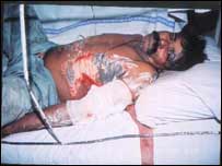 بس کا حادثہ