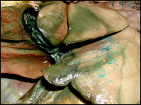  د تريخي ميکروبي کيدل 