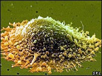 Célula de câncer de próstata