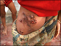 Kirliliğin yol açtığı düşünülen yaralar