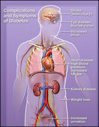 شکر( ډيابېټ )