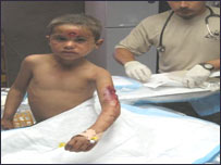 Dün Uruzgan'da yaralanan bir çocuk