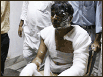  میرٹھ میں ایک تجارتی میلے میں آگ