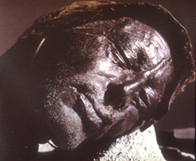 Image of the Tollund man whose body was preserved in a peat bog