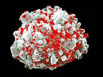 एचआईवी से संक्रमित कोशिका