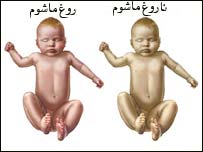 د روغ او ناروغ ماشوم په منځ کې توپير