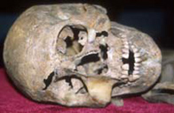 Photo of a warrior's skull found at the Repton dig
