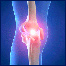 درد زانو