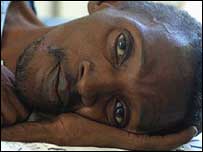 Um doente de tuberculose