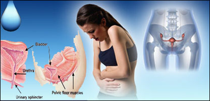 فستولا و مشکلات روانی